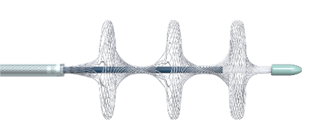 國內首創(chuàng)！本市研發(fā)生產的1款Ⅲ類創(chuàng)新醫(yī)療器械獲批上市，為具有溶栓禁忌癥的患者提供了治療選擇
